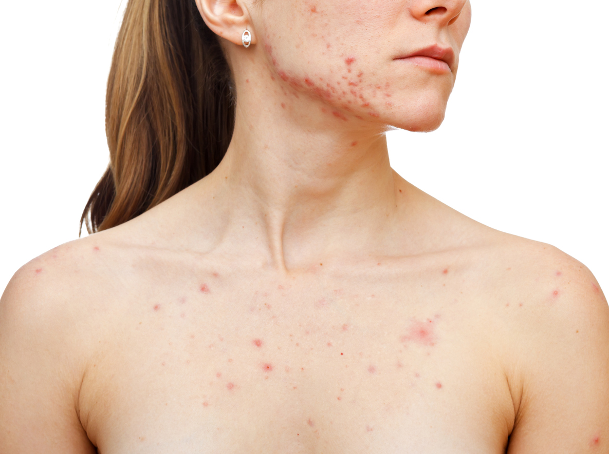 Skin problems